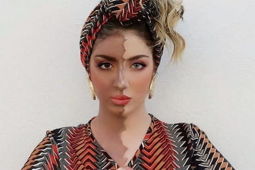 ǩڻƴǩ__ȥδ(ǩڻƴǩǩΪҪ)